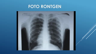 presentase peralatan radiologi pada mata kuliah peratan radiologi dasar ...