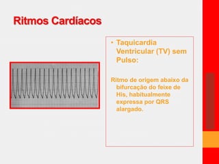 Ritmos Cardíacos 
• Taquicardia 
Ventricular (TV) sem 
Pulso: 
Ritmo de origem abaixo da 
bifurcação do feixe de 
His, habitualmente 
expressa por QRS 
alargado. 
 