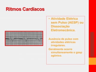 Ritmos Cardíacos 
• Atividade Elétrica 
sem Pulso (AESP) ou 
Dissociação 
Eletromecânica. 
Ausência de pulso com 
atividades elétricas 
irregulares. 
Geralmente ocorre 
simultaneamente o gasp 
agônico. 
 