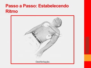 Passo a Passo: Estabelecendo 
Ritmo 
 