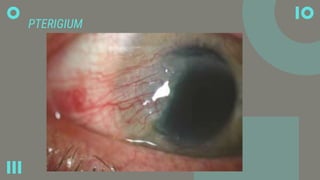 Hari Radiologi Sedunia 8 November: Mengenang Sinar-X, Menjaga Mata Kedokteran Modern