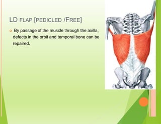 LD FLAP [PEDICLED /FREE]
 By passage of the muscle through the axilla,
defects in the orbit and temporal bone can be
repaired.
 
