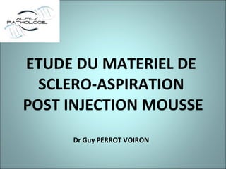 ETUDE DU MATERIEL DE SCLERO-ASPIRATION  POST INJECTION MOUSSE Dr Guy PERROT VOIRON 