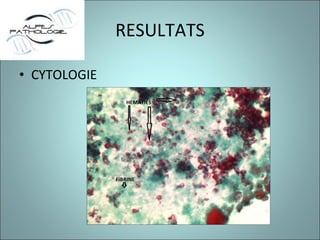 RESULTATS CYTOLOGIE 