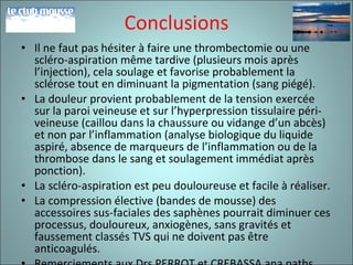 Conclusions Il ne faut pas hésiter à faire une thrombectomie ou une scléro-aspiration même tardive (plusieurs mois après l’injection), cela soulage et favorise probablement la sclérose tout en diminuant la pigmentation (sang piégé). La douleur provient probablement de la tension exercée sur la paroi veineuse et sur l’hyperpression tissulaire péri-veineuse (caillou dans la chaussure ou vidange d’un abcès) et non par l’inflammation (analyse biologique du liquide aspiré, absence de marqueurs de l’inflammation ou de la thrombose dans le sang et soulagement immédiat après ponction). La scléro-aspiration est peu douloureuse et facile à réaliser. La compression élective (bandes de mousse) des accessoires sus-faciales des saphènes pourrait diminuer ces processus, douloureux, anxiogènes, sans gravités et faussement classés TVS qui ne doivent pas être anticoagulés. Remerciements aux Drs PERROT et CREBASSA ana paths. 