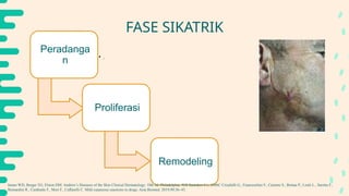 Scrofuloderma Presentation PPT SCROFULODERMA dalam kasus Kulit.pptx