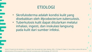Scrofuloderma Presentation PPT SCROFULODERMA dalam kasus Kulit.pptx