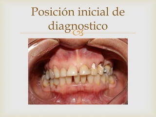 
Posición inicial de
diagnostico
 