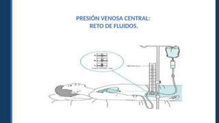 PRESIÓN VENOSA CENTRAL:
RETO DE FLUIDOS.
 