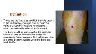 Definition
• These are the fractures in which there is breach
in the soft tissue envelope over or near the
fracture , such that fracture haematoma
communicates with external environment .
• The bone could be visible within the opening
wound at time of presentation or not Not
necessarily bone coming out i.e. all we can see
is a small opening wound while the bone got
back inside .
 