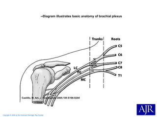Copyright © 2006 by the American Roentgen Ray Society
Castillo, M. Am. J. Roentgenol. 2005;185:S196-S204
--Diagram illustrates basic anatomy of brachial plexus
 