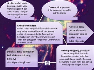 Artritis adalah suatu
bentuk penyakit yang
menyerang sendi dan
struktur atau jaringan
penunjang di sekitar
sendi

Osteoartritis, penyakit
ini merupakan penyakit
artritis kronik

Artritis reumathoid
Adalah suatu penyakit inflamasi sistematik
yang paling sering dijumpai, menyerang
sekitar 1% populasi dunia. Penyakit ini
menyebabkan sinovitis, nyeri, kerusakan
sendi, dan gangguan fungsional. Dikarenakan
kerusakan sendi

Dislokasi Yaitu perubahan
kedudukan sendi yang
biasanya
diikuti pembengkakan.

Ankilosis Yaitu
persendian sulit
digerakan karena
sudah lama
tidak digunakan.

Artritis pirai (gout), penyebab
utama penyakit ini adalah
hiperurisemia atau kelebihan
asam urat dalam darah. Biasanya
menyerang ibu jari kaki, dan sering
muncul pada tengah malam.

 