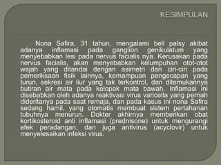 Nona Safira, 31 tahun, mengalami bell palsy akibat
adanya inflamasi pada ganglion genikulatum yang
menyebabkan lesi pada nervus facialis nya. Kerusakan pada
nervus facialis, akan menyebabkan kelumpuhan otot-otot
wajah yang ditandai dengan asimetri dan ciri-ciri pada
pemeriksaan fisik lainnya, kemampuan pengecapan yang
turun, sekresi air liur yang tak terkontrol, dan ditemukannya
butiran air mata pada kelopak mata bawah. Inflamasi ini
disebabkan oleh adanya reaktivasi virus varicella yang pernah
dideritanya pada saat remaja, dan pada kasus ini nona Safira
sedang hamil, yang otomatis membuat sistem pertahanan
tubuhnya menurun. Dokter akhirnya memberikan obat
kortikosteroid anti inflamasi (prednisone) untuk mengurangi
efek peradangan, dan juga antivirus (acyclovir) untuk
menyelesaikan infeksi virus.
 