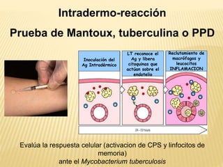 Intradermo-reacción
Prueba de Mantoux, tuberculina o PPD
Inoculación del
Ag Intradérmico
LT reconoce el
Ag y libera
citoquinas que
actúan sobre el
endotelio
Reclutamiento de
macrófagos y
leucocitos
INFLAMACION
Evalúa la respuesta celular (activacion de CPS y linfocitos de
memoria)
ante el Mycobacterium tuberculosis
 