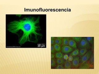 Imunofluorescencia
 