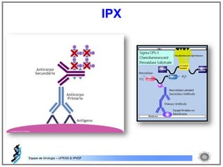 IPX
 