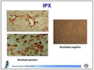 Resultado positivo
Resultado negativo
IPX
 