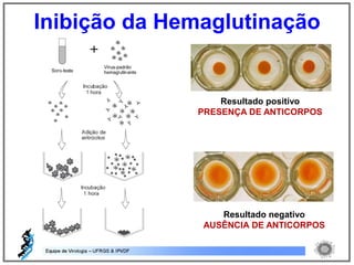 Resultado positivo
PRESENÇA DE ANTICORPOS
Resultado negativo
AUSÊNCIA DE ANTICORPOS
Inibição da Hemaglutinação
 