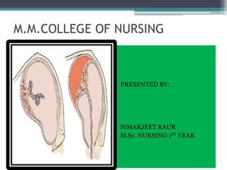 M.M.COLLEGE OF NURSING
PRESENTED BY:
SIMARJEET KAUR
M.Sc. NURSING 1ST YEAR
 