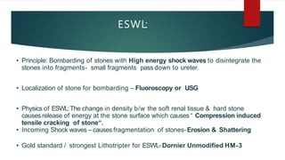 Urinary stone management | PPTX