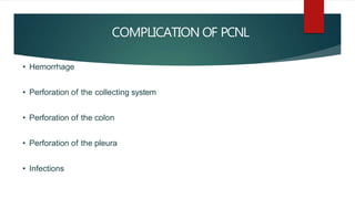 Urinary stone management | PPTX