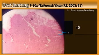 1. Serat Jantung Bercabang
10
1
 