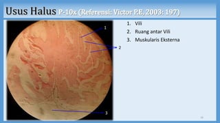 1. Vili
2. Ruang antar Vili
3. Muskularis Eksterna
16
1
2
3
 