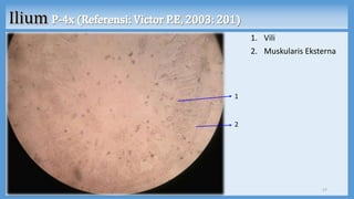 1. Vili
2. Muskularis Eksterna
17
1
2
 