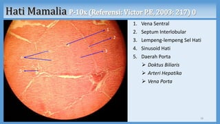 1. Vena Sentral
2. Septum Interlobular
3. Lempeng-lempeng Sel Hati
4. Sinusoid Hati
5. Daerah Porta
 Doktus Biliaris
 Arteri Hepatika
 Vena Porta
18
1
2
3
4
5
 