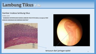 Gambar mukosa lambung tikus
Sumber: jurnal
“GAMBARAN HISTOPATOLOGIK MUKOSA LAMBUNG TIKUS PUTIH (Rattus norvegicus) YANG
DIINDUKSI KEBISINGAN DAN DIBERIKAN RANITIDIN “
tersusun dari jaringan epitel 19
 