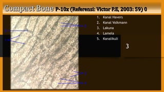 1. Kanal Havers
2. Kanal Volkmann
3. Lakuna
4. Lamela
5. Kanalikuli
3
1
2
3
4
5
 