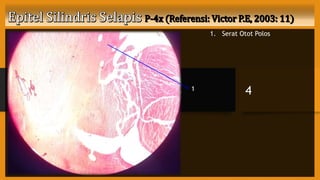 1. Serat Otot Polos
41
 