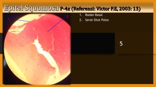 1. Badan Basal
2. Serat Otot Polos
5
1
2
 