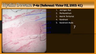 1. Jaringan Ikat
2. Perikondrium
3. Matrik Teritorial
4. Kondrosit
5. Kondrosit Muda
7
1
2
3
4
5
 