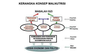 KERANGKA KONSEP MALNUTRISI
 