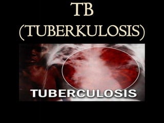 TB
(TUBERKULOSIS)
 