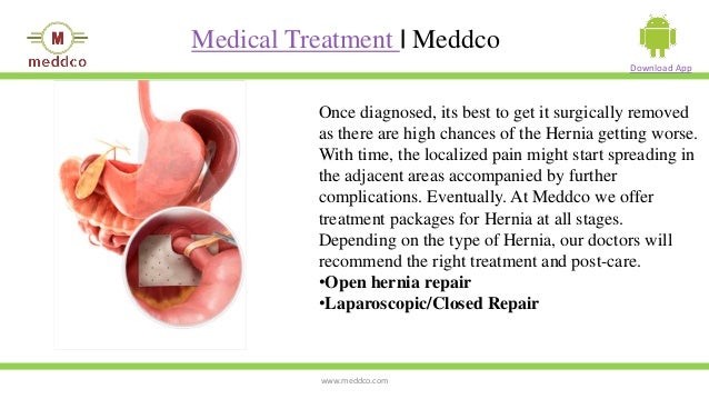 All About Hernia (Causes, Symptoms, and Treatment)
