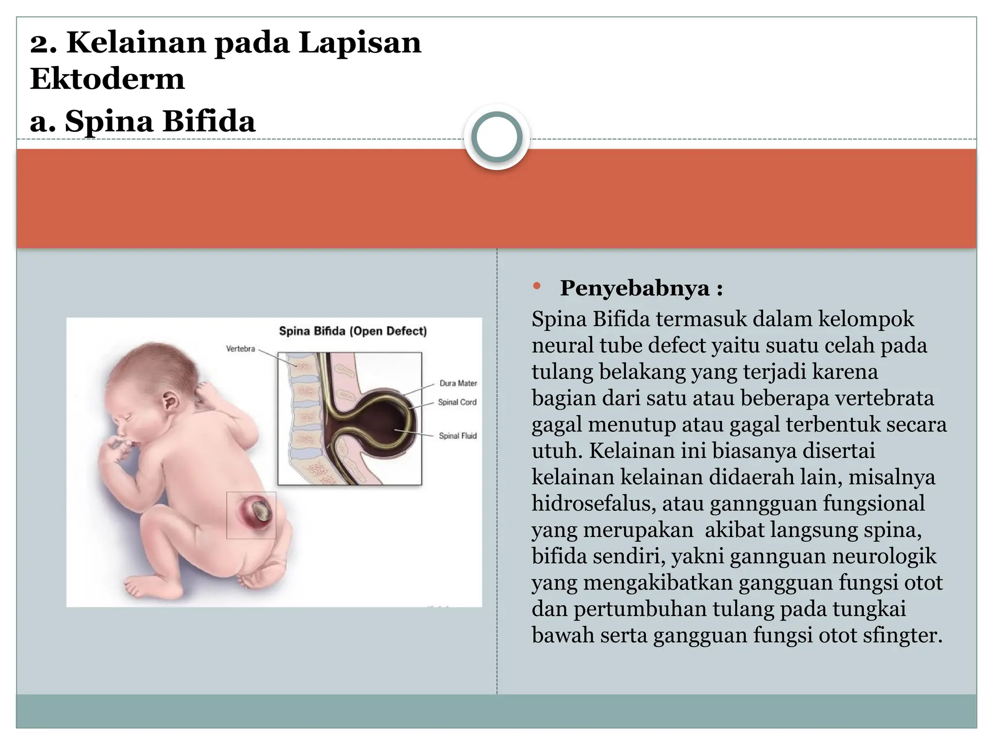 PPT Teratologi......................pptx