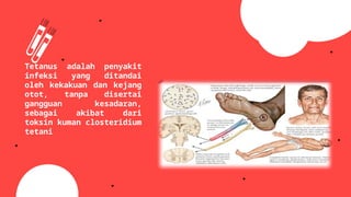 Clostridium tetani(Tetanus) by Nurfaizah Yusuf | PPTX