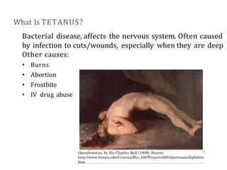 Tetanus Matrix Power Point of Tetanus and vaccine -1.pptx