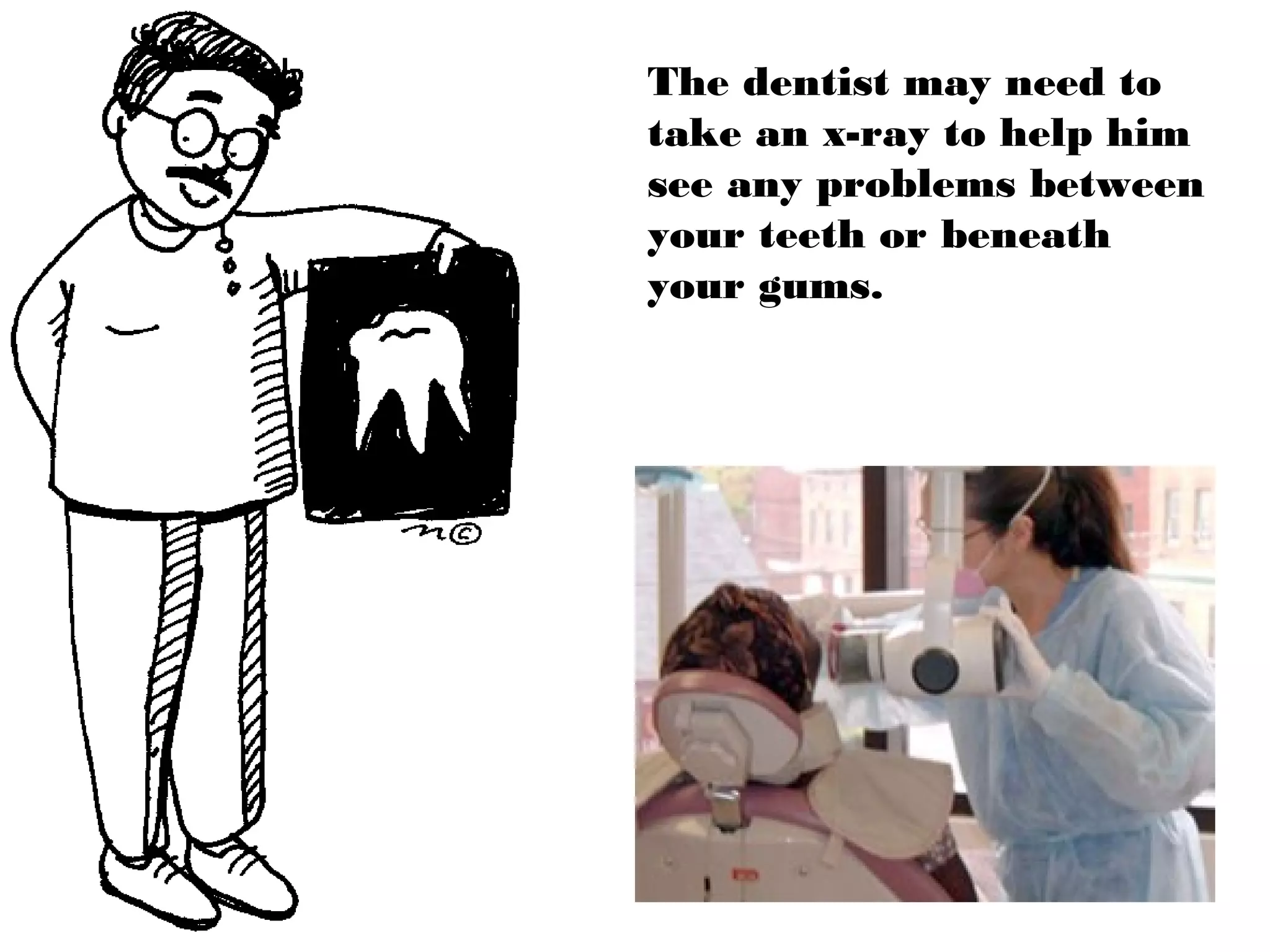 The dentist may need to
take an x-ray to help him
see any problems between
your teeth or beneath
your gums.