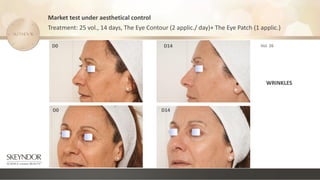 Market test under aesthetical control
Treatment: 25 vol., 14 days, The Eye Contour (2 applic./ day)+ The Eye Patch (1 applic.)
Vol. 26
D0
D0
D14
D14
WRINKLES
 