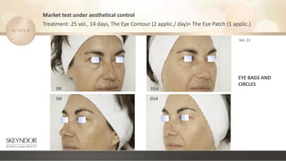 Market test under aesthetical control
Treatment: 25 vol., 14 days, The Eye Contour (2 applic./ day)+ The Eye Patch (1 applic.)
Vol. 21
EYE BAGS AND
CIRCLES
D0 D14
D14
D0
 