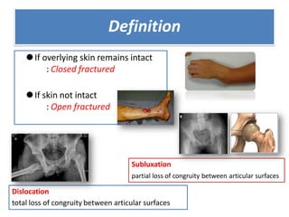 PPT trauma muskuloskeletal dr. Satria, Sp.OT.pptx