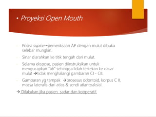 • Proyeksi Open Mouth
- Posisi supine ~pemeriksaan AP dengan mulut dibuka
selebar mungkin.
- Sinar diarahkan ke titik tengah dari mulut.
- Selama ekspose, pasien diinstruksikan untuk
mengucapkan “ah” sehingga lidah tertekan ke dasar
mulut tidak menghalangi gambaran CI - CII.
- Gambaran yg tampak prosesus odontoid, korpus C II,
massa lateralis dari atlas & sendi atlantoaksial.
 Dilakukan jika pasien sadar dan kooperatif.
 