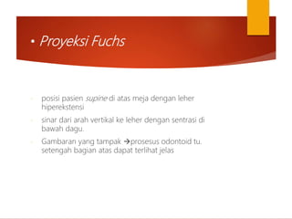 • Proyeksi Fuchs
- posisi pasien supine di atas meja dengan leher
hiperekstensi
- sinar dari arah vertikal ke leher dengan sentrasi di
bawah dagu.
- Gambaran yang tampak prosesus odontoid tu.
setengah bagian atas dapat terlihat jelas
 