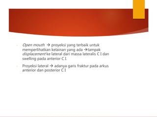 - Open mouth  proyeksi yang terbaik untuk
memperlihatkan kelainan yang ada tampak
displacement ke lateral dari massa lateralis C I dan
swelling pada anterior C I.
- Proyeksi lateral  adanya garis fraktur pada arkus
anterior dan posterior C I
 