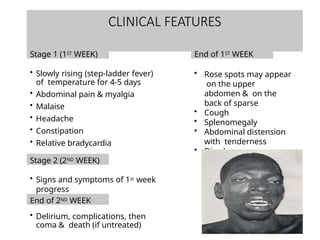 ppt typhoid.pptx enteric fever ppt full diagnosis | PPTX
