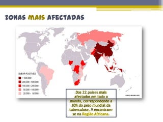 Falta de apetite, anorexia, apatia completa com quase tudo o que está à sua volta.Como se transmite??A tuberculose é uma doença contagiosa que se transmite de pessoa para pessoa.Ao falar, tossir ou espirrar, os doentes não tratados costumam expulsar grandes quantidades de bactérias no ambiente. Essas bactérias podem ser inspiradas por pessoas saudáveis, levando ao adoecimento.