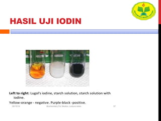 HASIL UJI IODIN
 
